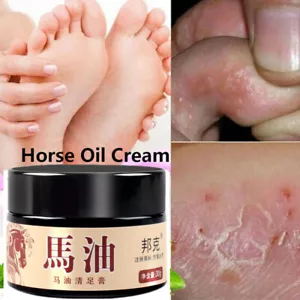 30 g Crema para pies de aceite de caballo antiseca grietas cuidado de la piel talón agrietado peeling reparación - Imagen 1 de 5