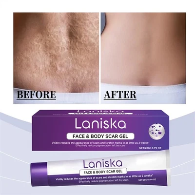 28G Scar Reducing Cream Face Body Scar Gel  Improve Skin Enhance Skin Smoothness - Image 1 of 4