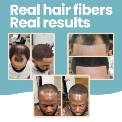 Hair Fibers by HAIR ILLUSION - Baldness & Thinning Hair Treatment for Men, Women - Image 1 of 4