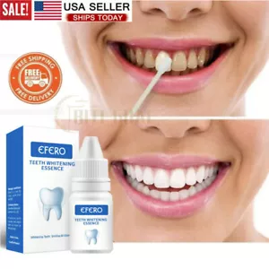Teeth Whitening Gel Pen Extra Strong White Hygiene Tooth Whitener Stain Removal- - Picture 1 of 12