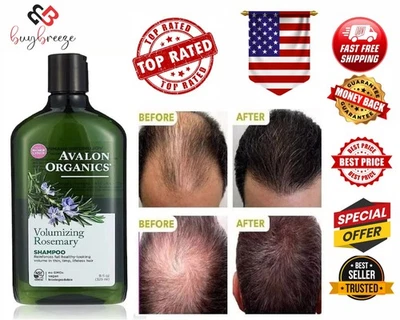 Avalon Organics Rosemary Shampoo 11oz – Natural Volume Boost for Fine Hair - Image 1 of 4