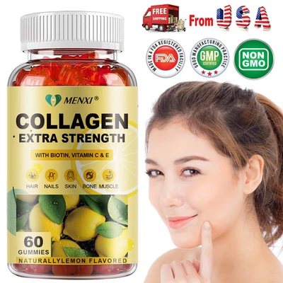 Gomitas de colágeno hidrolizado con vitamina C, zinc y biotina - 60 gomitas inmunes Foto 1 de 4