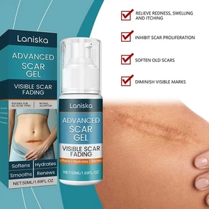 50ml Scar Fading Acne Cream Silicone Removal Fade Old New Treatments Body - Picture 1 of 12