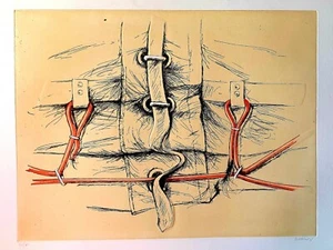 PETER KLASEN*GRAVURE*CARBORINBUM*ORIGINALE*RELIEF*1980*RARE*N°45/60*MUSÉE*ART* - Picture 1 of 12