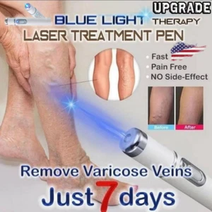 Laser Azul Para Eliminar Estrias De Las Venas Varicosas Varices Cuerpo Piel États-Unis - Photo 1 sur 13
