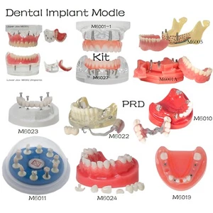 Dental Implant Modle,Demo RPD/ Overdenture/All-On-4 Treatment Restoration Type - Picture 1 of 164