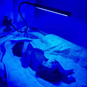 Jaundice Light Therapy Newborn Bilirubin Lamp Neonatal Jaundice Blue Ray Light - Picture 1 of 10