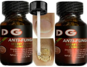 Fungus clear nail toenail support capsules athletes foot 2 Bottles - Picture 1 of 8
