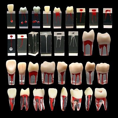 10Pcs Dental Endo Root Canal Teeth Model Practice Block RCT Pulp Cavity Study • 21.24$