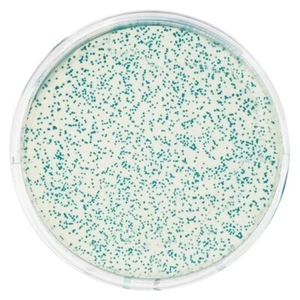 Transformation von E. coli mit pGAL™ (blaue Kolonie) - Bild 1 von 2