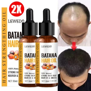 2Pcs Batana Oil Serum for Hair Growth, Batana Oil Essence, Repair Damaged Hair - Picture 1 of 13