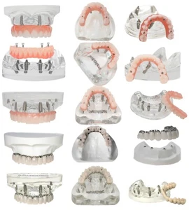 Demo Overdenture All On 4 & All On 6 treatment Dental Implant Model 4/6 Screws - Picture 1 of 83