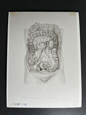 Dickdarm (Grimmdarm) & Bauchorgane - Barbara Ruppel 1986 - Anatomische Zeichnung