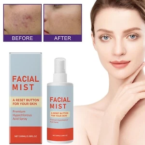 Soothing Calming Spray Oil Control Shrink Pores Repair Pimple Marks For Closed - Picture 1 of 19