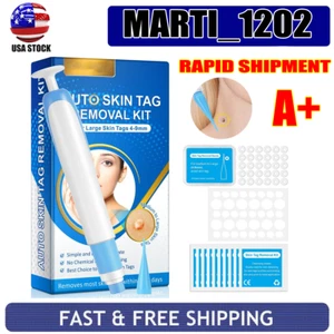 Auto Micro Skin Tag Remover Device Kit Safe Painless Removal Tool Adult Mole New - Picture 1 of 5