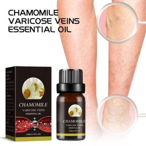 Marronie Chamomile Essential Oil For Varicose Veins -2023- Legs Treatment N2F0 - Picture 1 of 10
