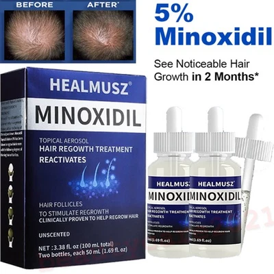Minoxidil 5% Extra Strength Men 2 Month Supply Hair Regrowth Solution 2 Bottles - Image 1 of 4