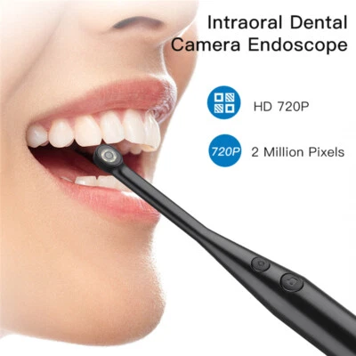 HD 2.0 megapíxeles dental USB cámara intraoral imagen digital endoscopio oral Foto 1 de 4