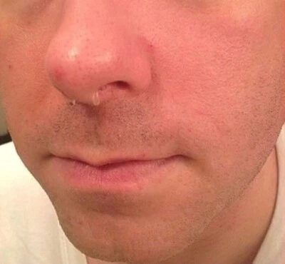 2 PÇS REATINADORES DE SEPTO QUASE INVISÍVEIS calibre 10 6 X 3mm transparente. - Imagem 1 de 4