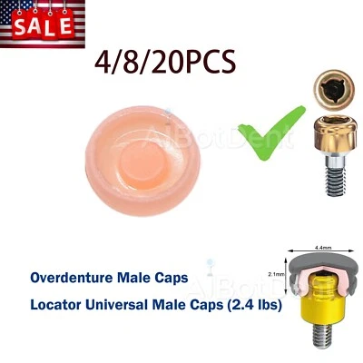 Tampas de implante de retenção de overdenture dental EUA 4/8/20 peças 2,4 lb rosa serve no localizador - Imagem 1 de 4