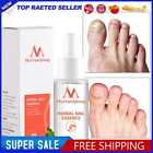 30ml Nail Whitening Serum Anti Infection Foot Care Serum for Hand Foot Skin Care