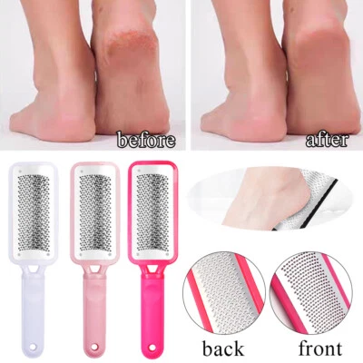Foot Rasp File Callus Remover Hard Dead Rough Skin Scrubber Pedicure Tool - Image 1 of 4