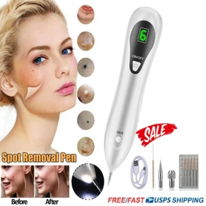 Anti-Aging Laser Plasma Pen Mole Removal Dark Spot Skin Tag Tattoo Wart Remover - Picture 1 of 11