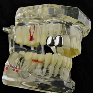 Double Cap Silver Tone Grillz Canine Teeth Connected Single Right Tooth Grills - Picture 1 of 6