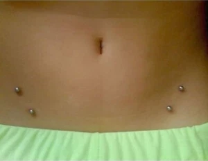 Sterilized Surgical Steel Pair 14g, 45 Degre, 1" Surface Bar for Hip Piercings - Picture 1 of 4