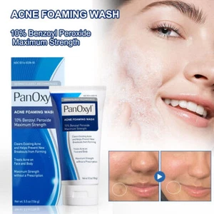 PanOxyl, Acne Foaming Wash, Benzoyl Peroxide 4%/10% , 5.5 oz DE - Bild 1 von 9