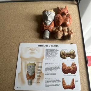 Schilddrüse GPI Anatomisches Modell 4-teiliges Set Machen Sie uns ein Angebot - Bild 1 von 3