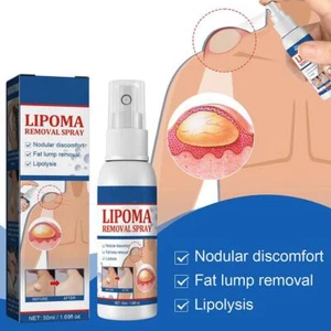 50ml Lipomheilung Reduction Spray, Instant LumpFree best Lipoma Removal E2Y8 - Picture 1 of 17