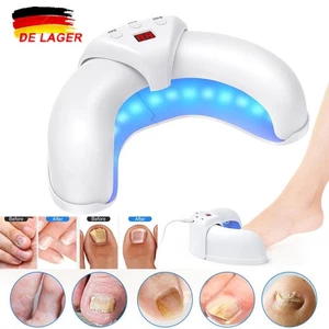 Laser Nagelpilz Fungal-Nail Therapie Lasergerät Fungus Lazer für Heimgebrauch DE - Bild 1 von 22