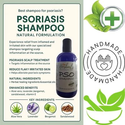 Scalp Psoriasis Treatment Shampoo Natural Handmade Relief for Flaky Itchy Scalp - Image 1 of 4