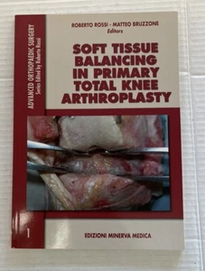 SOFT TISSUE BALANCING IN PRIMARY TOTAL KNEE ARTHROPLASTY By Roberto Rossi - Picture 1 of 2