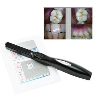 Cámara intraoral dental de alta resolución de 6 MP con 6 LED USB 2.0 para oral transparente Foto 1 de 4