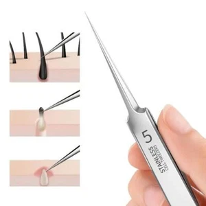 1 Pack No.5 Fine Acne Tweezers Blackhead Remover Needle Tool for Skin Care - Picture 1 of 24