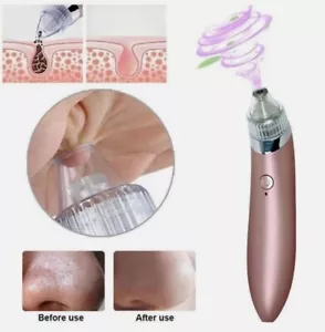 Rechargeable Acne Blackhead Remover Vacuum Suction Device Pore Cleaner Beauty US - Picture 1 of 5
