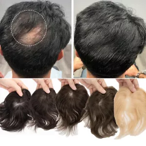 Parche para cabello de punto calvo toupee para hombre piezas de encubrimiento de piel de PU adorno de cabello humano - Imagen 1 de 11