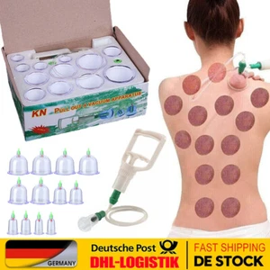 Schröpfen Set Mit 12tlg Schröpfgläser Cupping Schröpfset Für Vakuum Massage Cups - Bild 1 von 24