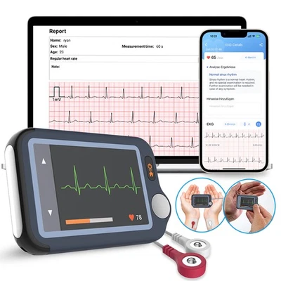 CHECKME EKG Gerät mit KI-Analysefunktion, 30s/ 60s/5min Messzeit für Smartphone und PC