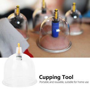 (Round)Vacuum Cupping Cup Cupping Therapy Portable Vacuum Suction Cup VIS