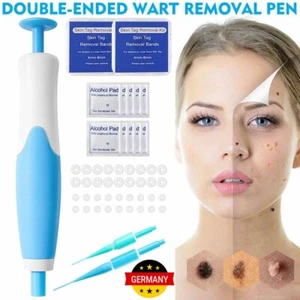 Stielwarzen Entfernen Schnell Kit,Skin Tag Remover Kit 2 in 1 Für Micro Bis Larg - Bild 1 von 20