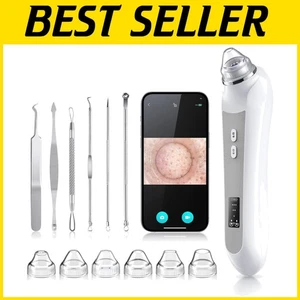 Portable Pore Vacuum with HD Camera & Adjustable Suction - Skin Care Kit - Picture 1 of 9