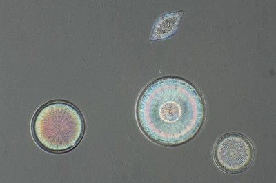 Vintage R.I.Firth Microscope Slide. Selected Diatoms - Image 1 of 2