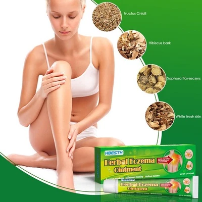 20G Herbal Eczema Ointment Skin External Use Cream for Eczema Pruritus - Image 1 of 4