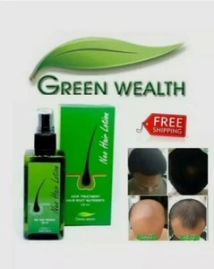 Neo Hair Lotion 120ml, 100% Original Authentic MFG: 22/01/2025 - Picture 1 of 6