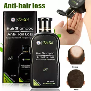 Hair Growth Shampoo Hair Regrowth Treatment Anti-Hair Loss Shampoo For Men&Women - Picture 1 of 28