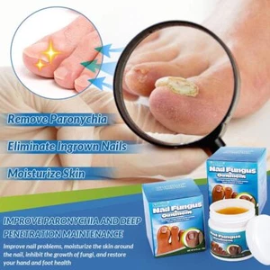 Foot Nail Repair Cream Quick-Healing Nail Fungus Ointment 20g GTR9 GTR9 - Picture 1 of 9