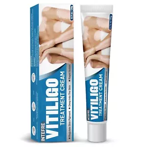 Crema De Vitiligo Tratamiento Natural Reduce Las Manchas Blancas y Pigmentacion - Picture 1 of 8